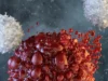 Cientistas aproveitam células assassinas naturais para combater cânceres agressivos