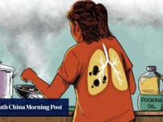 O tabagismo é baixo, mas por que as mulheres de Hong Kong têm câncer de pulmão?