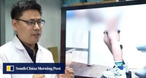 Robô chinês ajuda crianças com distúrbios neurológicos a se levantarem pela primeira vez.