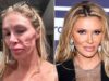 Brandi Glanville diz que seu parasita facial está de volta: ‘Achei que estava curada’