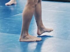 Novas imagens revelam a lesão de Conor McGregor que levou ao cancelamento da luta de Michael Chandler.