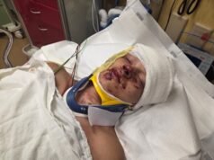 ‘Seu nariz tombou sobre os olhos’: depois de fugir da guerra, a família Clackamas enfrenta uma nova luta depois que o filho adolescente vira