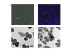 Indicações direcionadas para tratamento de infecções por Pseudomonas aeruginosa na fibrose cística – veja a chave para açúcares