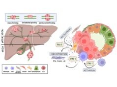 SERPINE1 é a chave para o tratamento do colangiocarcinoma