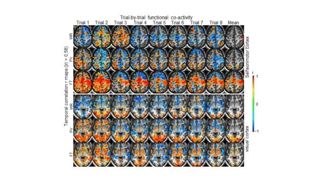 The-Commonality-and-Individuality-of-Human-Brains-When-Performing-Tasks-1.jpg