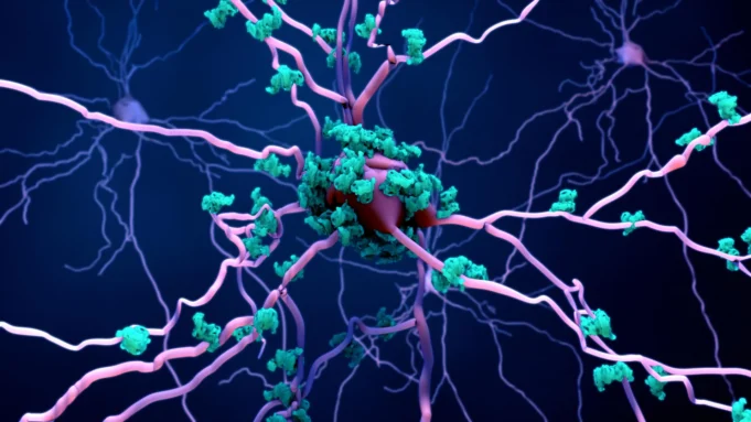 Cientistas podem ter finalmente descoberto como o Alzheimer mata células cerebrais