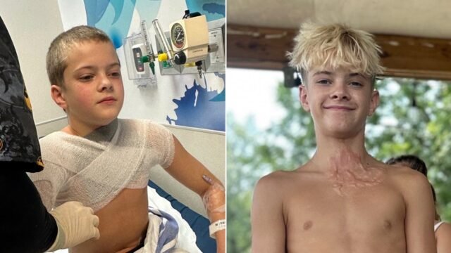 child-suffers-burns.jpg
