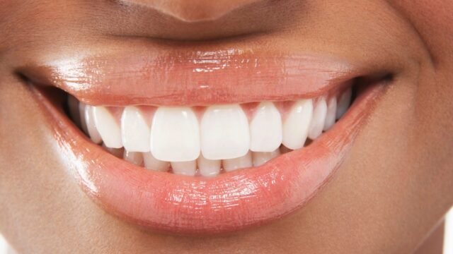 closeup-of-woman-smiling-with-perfect-white-teeth-by-mdbpixs-adobe-stock.jpg