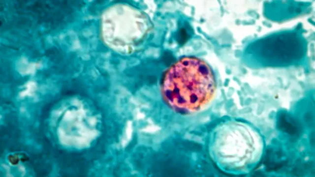 cyclospora-cayetanensis-oocysts.webp.webp