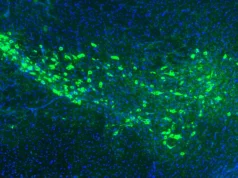 Pesquisadores de Yale podem ter descoberto como a doença de Parkinson se espalha pelo cérebro