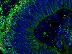 Um minicérebro desenvolvido em laboratório pode prever quais tratamentos para Alzheimer funcionarão