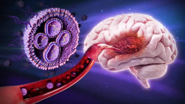 glioblastoma-nanomedicine.webp.webp