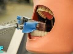 Robôs dentários podem realizar procedimentos de coroa