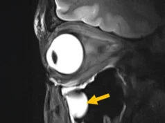 Uma nova ressonância magnética inovadora mostra o cérebro e os olhos como nunca antes