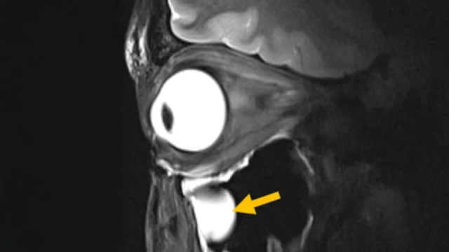 high-resolution-eye-mri.webp.webp