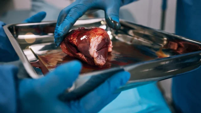 hospital-doctors-organ-transplant-surgery.webp.webp