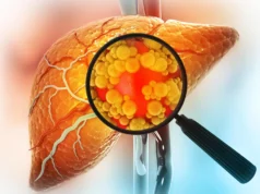 Um medicamento experimental trata a doença hepática gordurosa grave reparando o intestino