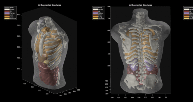 ultrasound_phantom_segmentation-b254a71d083eb5c9.png
