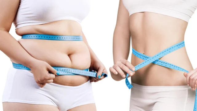 woman-weight-loss-success-before-after.webp.webp